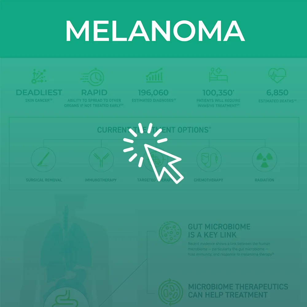 The microbiome and melanoma