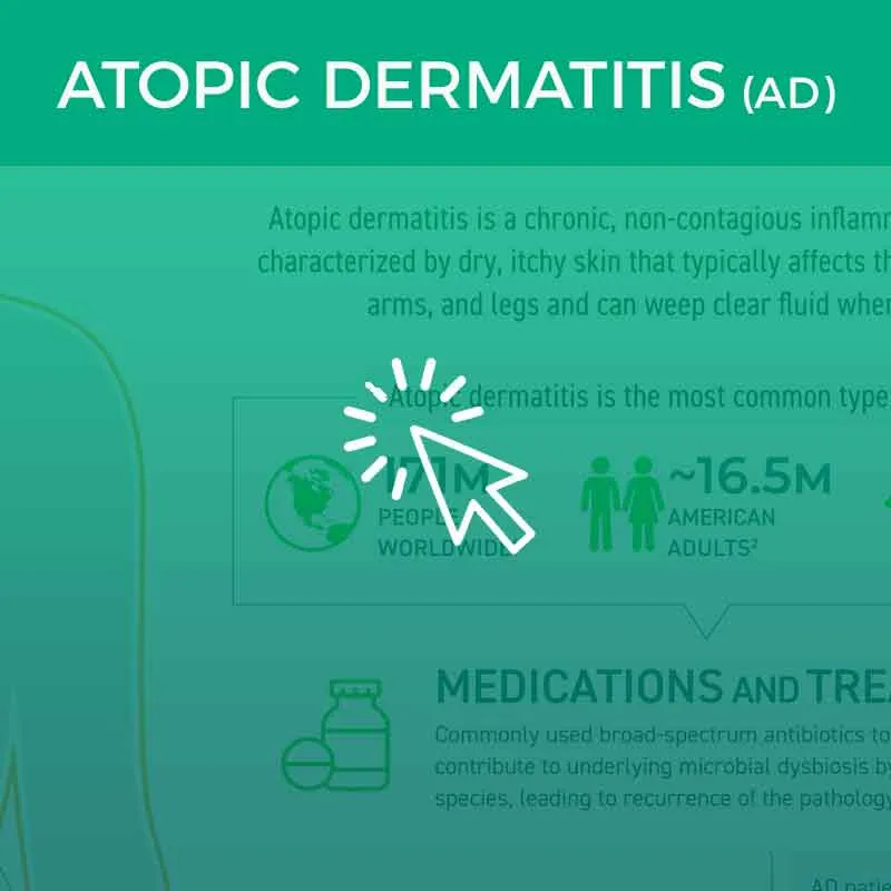 The microbiome and atopic dermatitis